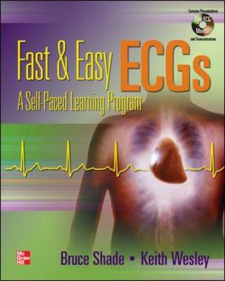 Fast and Easy ECGs