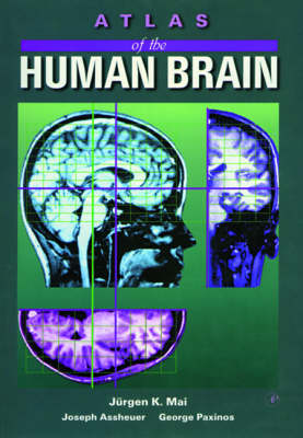 Atlas of the Human Brain