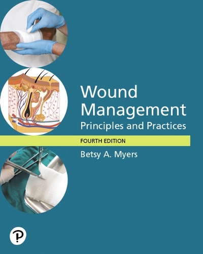 Wound Management