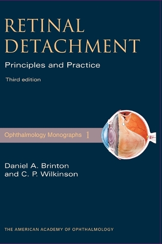 Retinal Detachment
