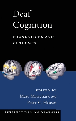 Deaf Cognition