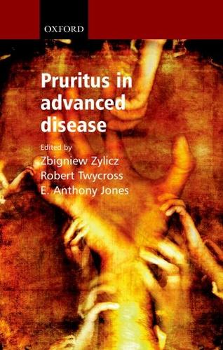 Pruritus in Advanced Disease