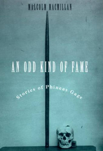 An Odd Kind of Fame