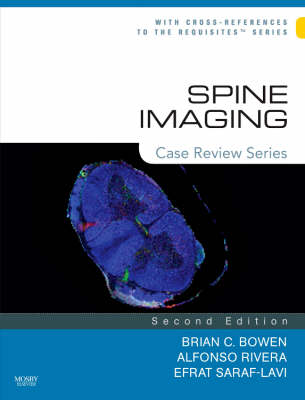 Spine Imaging