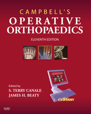 Campbell's Operative Orthopaedics E-dition