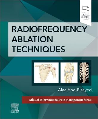 Radiofrequency Ablation Techniques