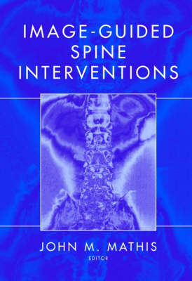 Image-Guided Spine Interventions