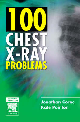 100 Chest X-Ray Problems