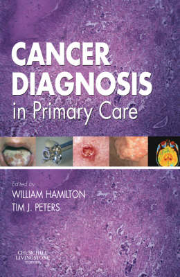 Cancer Diagnosis in Primary Care