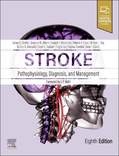 Stroke: Pathophysiology, Diagnosis, and Management