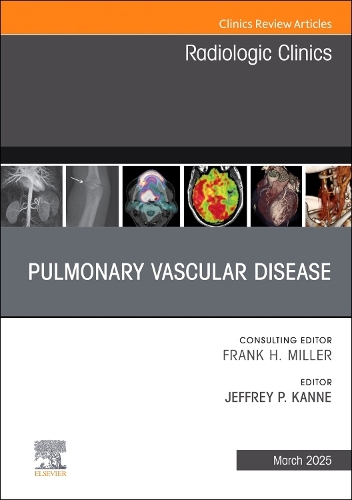 Pulmonary Vascular Disease, An Issue of Radiologic Clinics of North America Volume 63-2