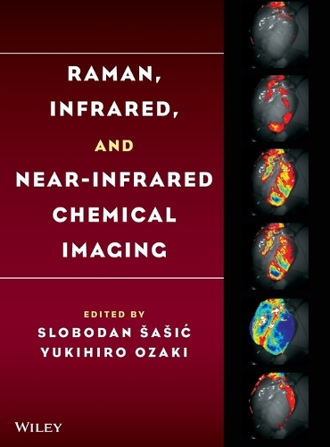 Raman, Infrared, and Near-Infrared Chemical Imaging
