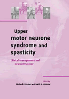 Upper Motor Neurone Syndrome and Spasticity