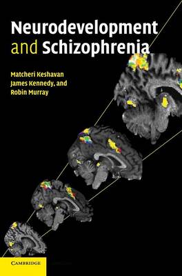 Neurodevelopment and Schizophrenia
