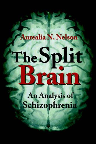 The Split Brain