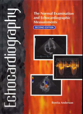 Echocardiography