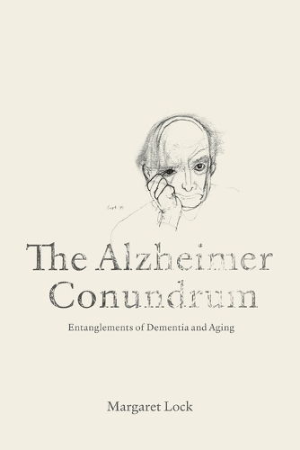 The Alzheimer Conundrum