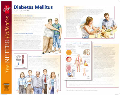 Frank H. Netter Diabetes and Complications Poster