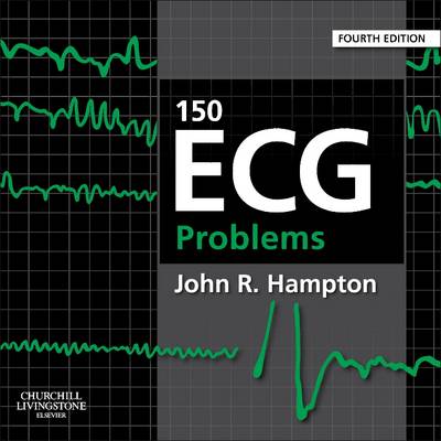 150 ECG Problems