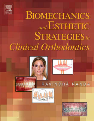 Biomechanics and Esthetic Strategies in Clinical Orthodontics
