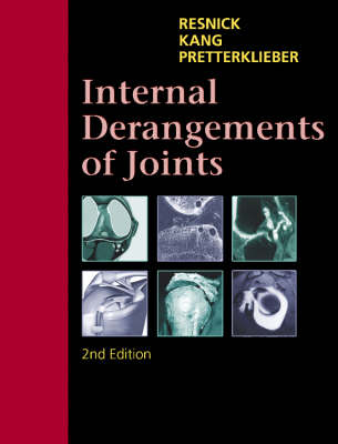 Internal Derangements of Joints