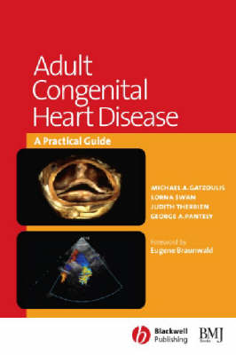 Adult Congenital Heart Disease
