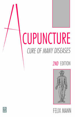 Acupuncture