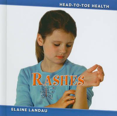 Rashes