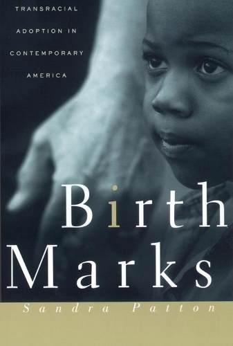 Birthmarks