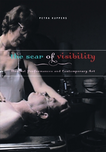 The Scar of Visibility
