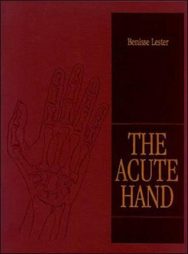 Acute Hand