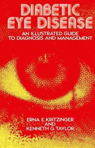 Diabetic Eye Disease
