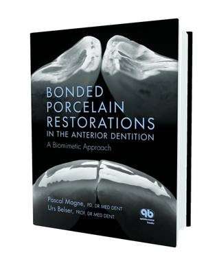 Bonded Porcelain Restorations in the Anterior Dentition