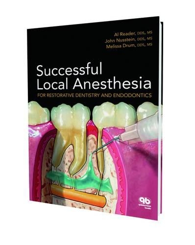 Successful Local Anaesthesia