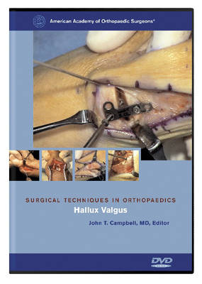 Surgical Techniques in Orthopaedics