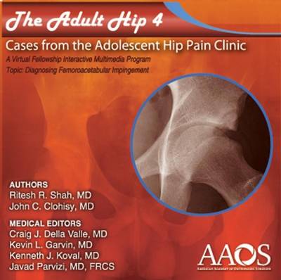 The Adult Hip: Diagnosing Femoroacetabular Impingement (FAI) Volume 4