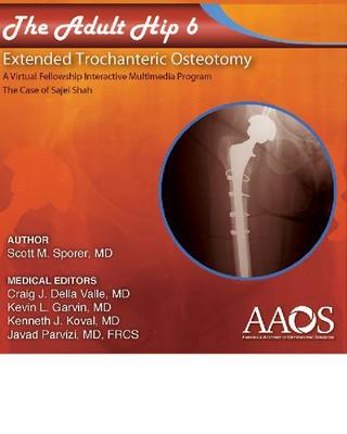 The Adult Hip 6: Extended Trochanteric Osteotomy