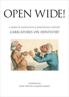 Open Wide!