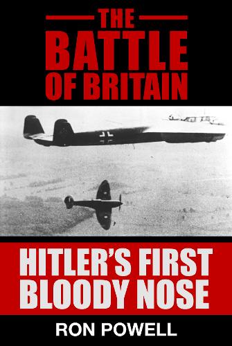 The Battle of Britain, Hitler's First Bloody Nose