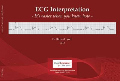 ECG Interpretation