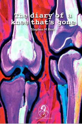 The diary of a knee that's gone