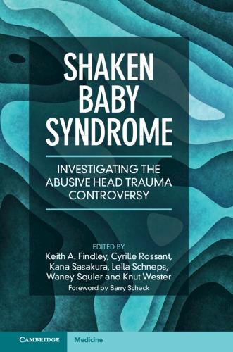 Shaken Baby Syndrome
