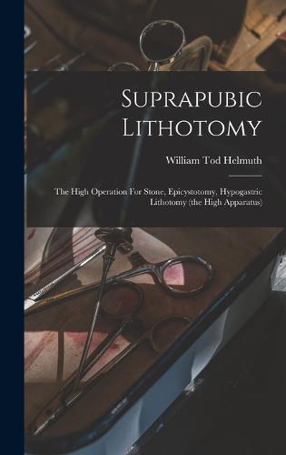 Suprapubic Lithotomy