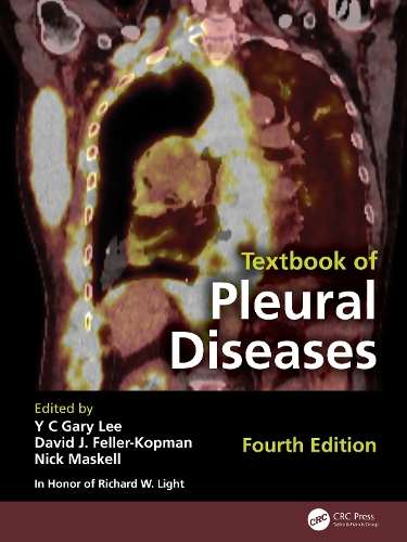 Textbook of Pleural Diseases