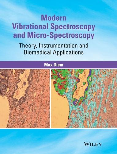 Modern Vibrational Spectroscopy and Micro-Spectroscopy