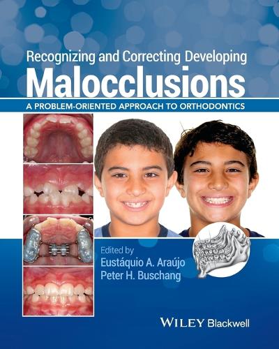 Recognizing and Correcting Developing Malocclusions
