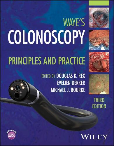 Waye's Colonoscopy