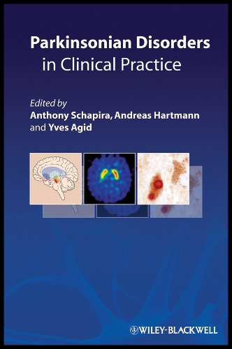 Parkinsonian Disorders in Clinical Practice