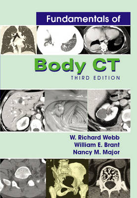 Fundamentals of Body CT