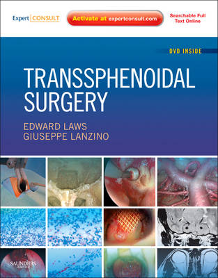Transsphenoidal Surgery